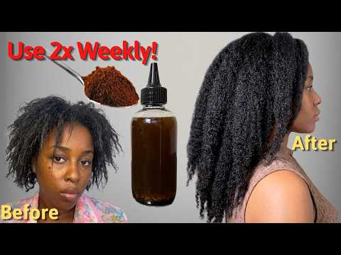 My Hair Grew Too Wild & Thick to Handle after using this… Grow Thicker Hair in 90days