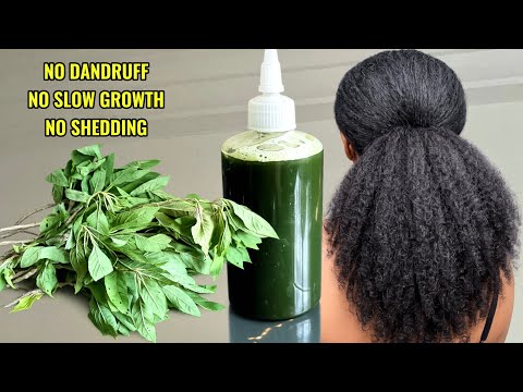 MY HAIR WON'T STOP GROWING WILD WITH THIS TREATMENT