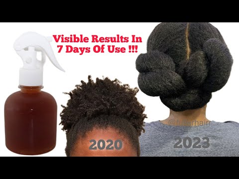 Your hair may become too thick to handle in JUST 2 WEEKS of using this hair tea 🔥