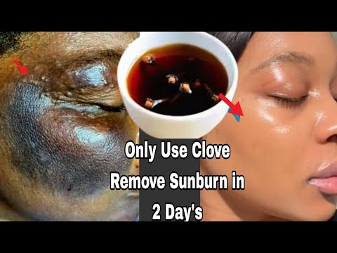 2 in 1cloves water l challenge – Lighten your scars, Dark spots and Get Glowing spotless skin