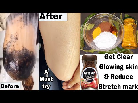 A must try / body scrub for glowing skin stretch mark removal/diy coffee body scrub & Polish #coffee