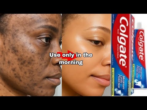 Colgate toothpaste for face whitening   Lemon and colgate