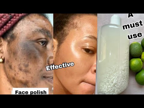 Rice water challenge – lighten your scars, Dark spots and Get Glowing spotless skin