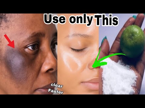 Salt Erases all Wrinkles Even at 70! Anti Aging Skin Care